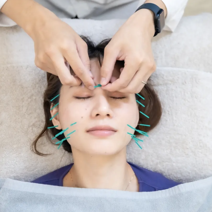 【初回限定】トライアル美容鍼 60分